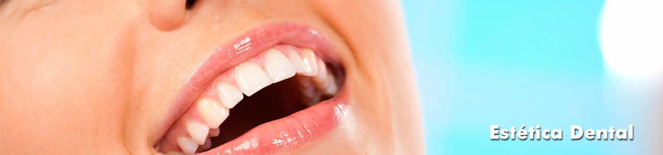 clinica-somosaguas-pozuelo-alarcon-estetica-dental