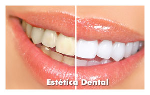 clinica-somosaguas-pozuelo-alarcon-estetica-dental