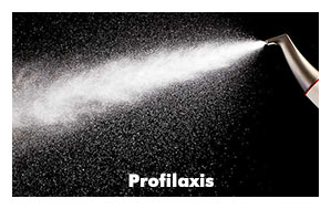 clinica-somosaguas-pozuelo-alarcon-profilaxis