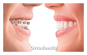 clinica-somosaguas-pozuelo-alarcon-ortodoncia