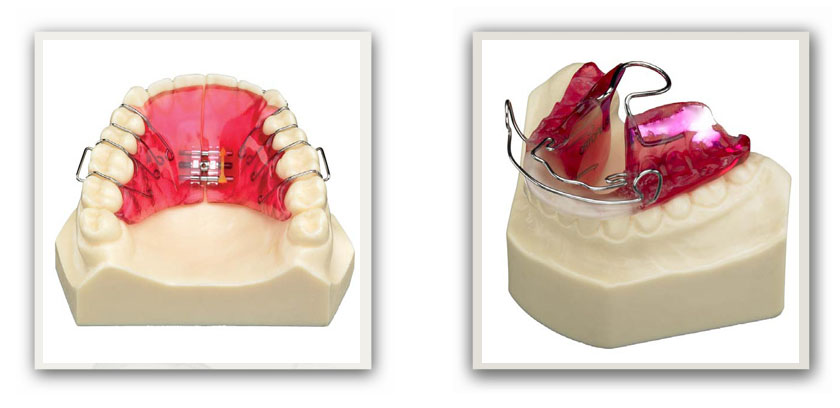 clinica-somosaguas-pozuelo-alarcon-ortodoncia