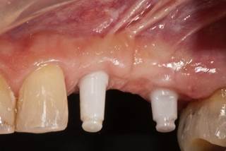 whiteSKY Gingiva-1-23.jpg